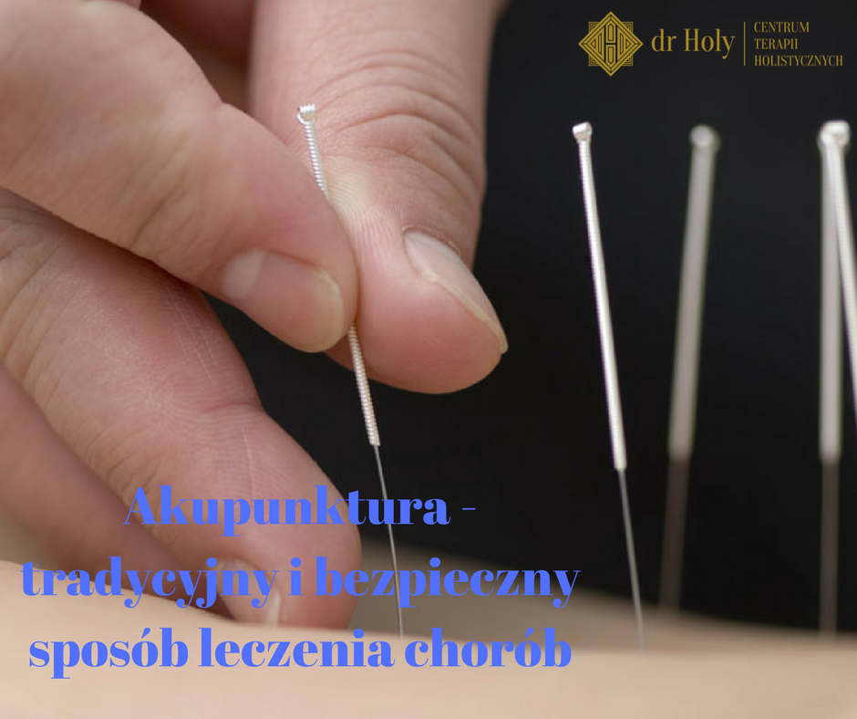 Akupunktura Opole